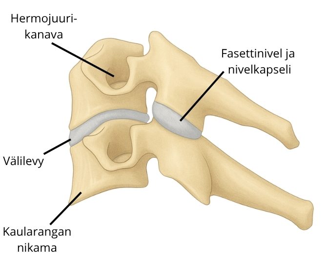 Niskakipu johtuu usein fasettinivelistä